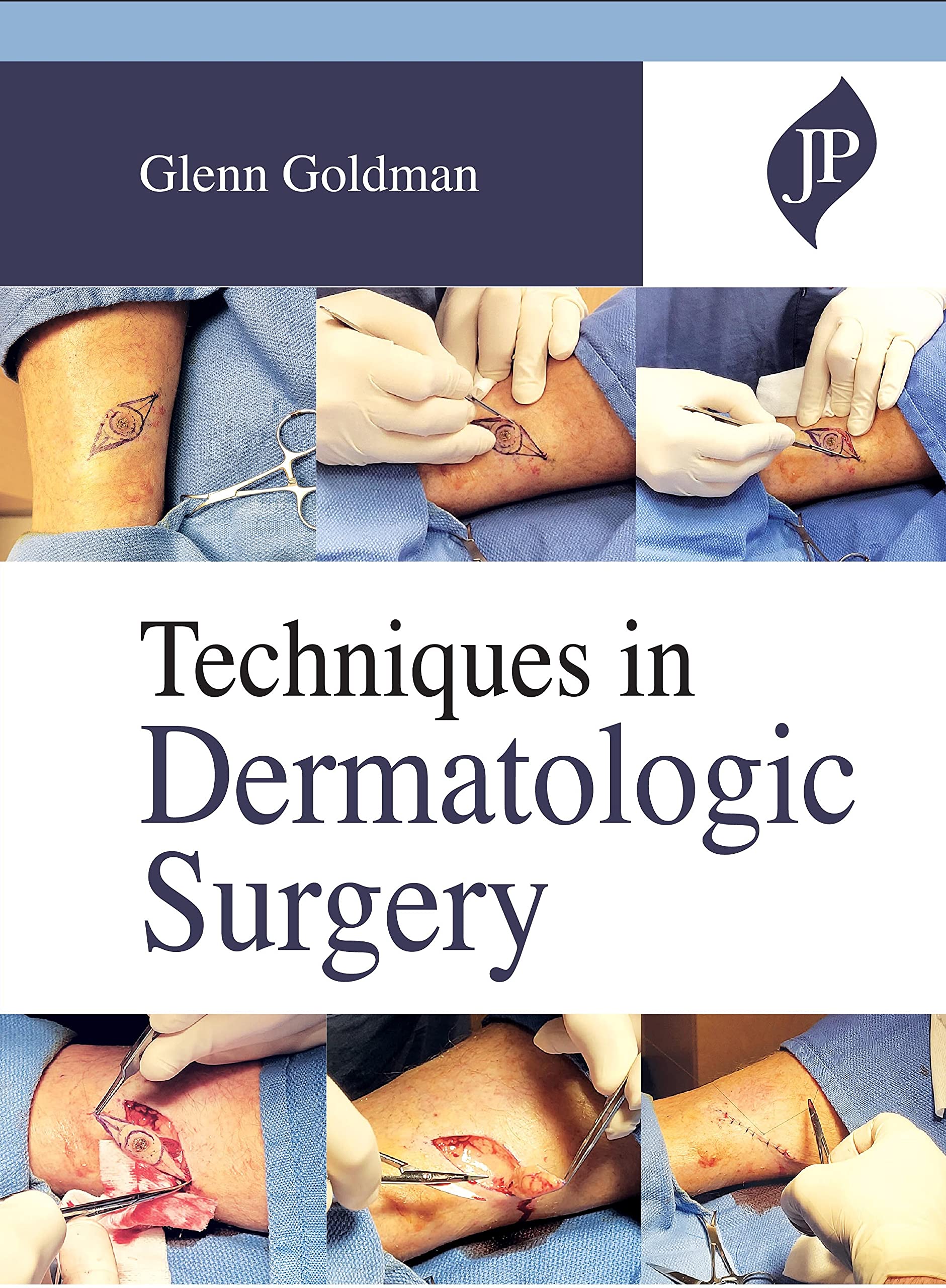 Techniques In Dermatologic Surgery
