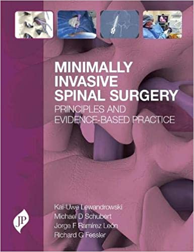 Minimally Invasive Spinal Surgery Principles And Evidence-Based Practice