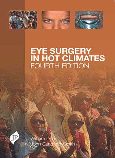 Eye Surgery In Hot Climates