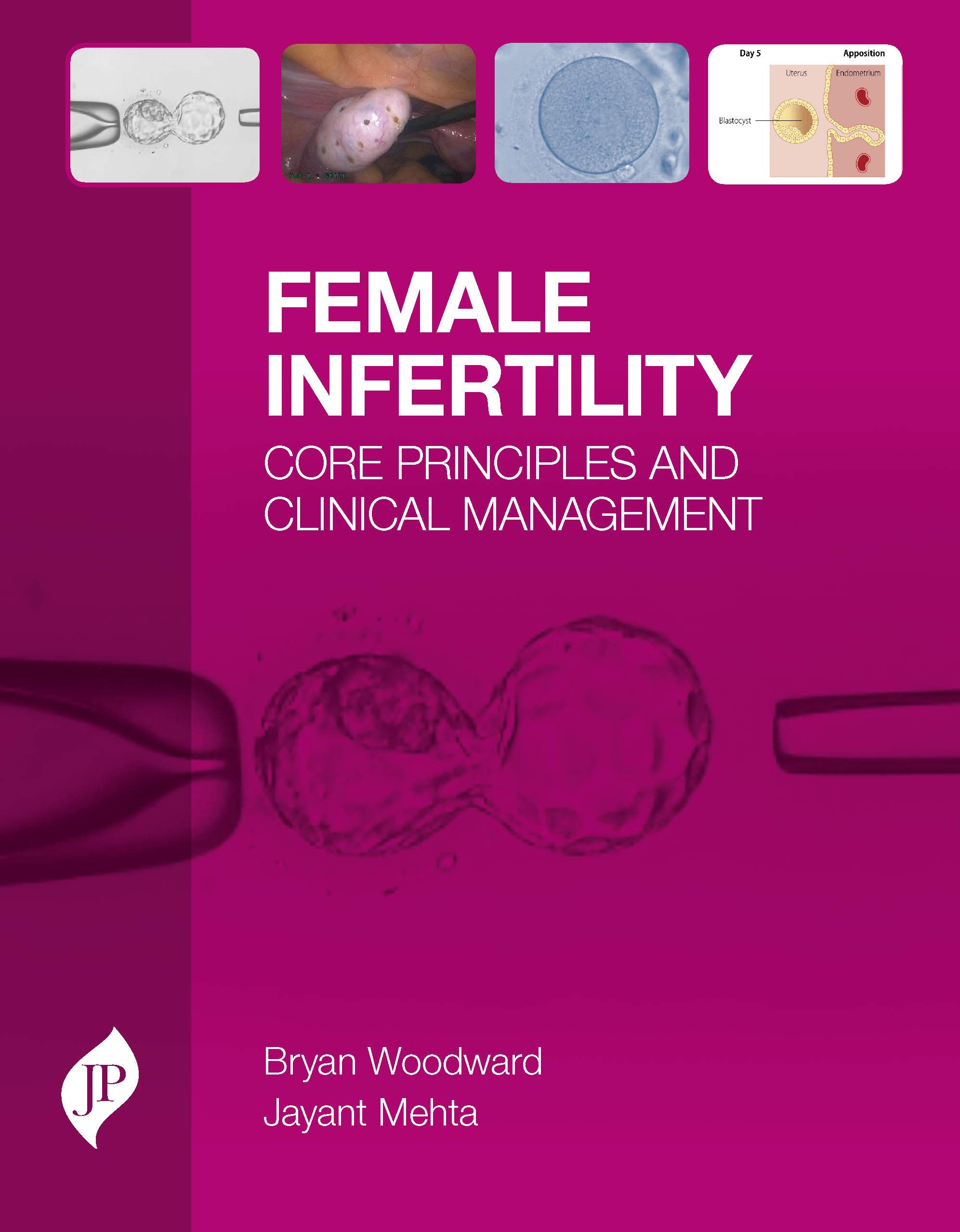 Female Infertilty: Core Principles And Clinical Management
