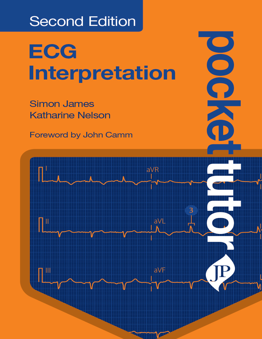 Ecg Interpretation Pocket Tutor