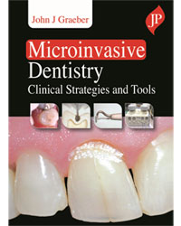 Microinvasive Dentistry: Clinical Strategies And Tools