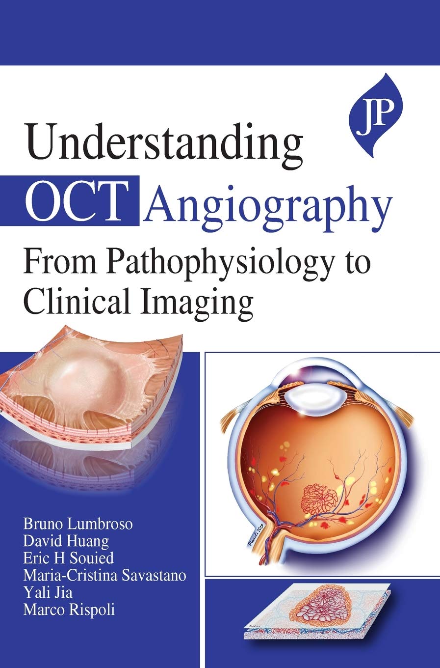 Understanding Oct Angiography From Pathophysiology To Clinical Imaging