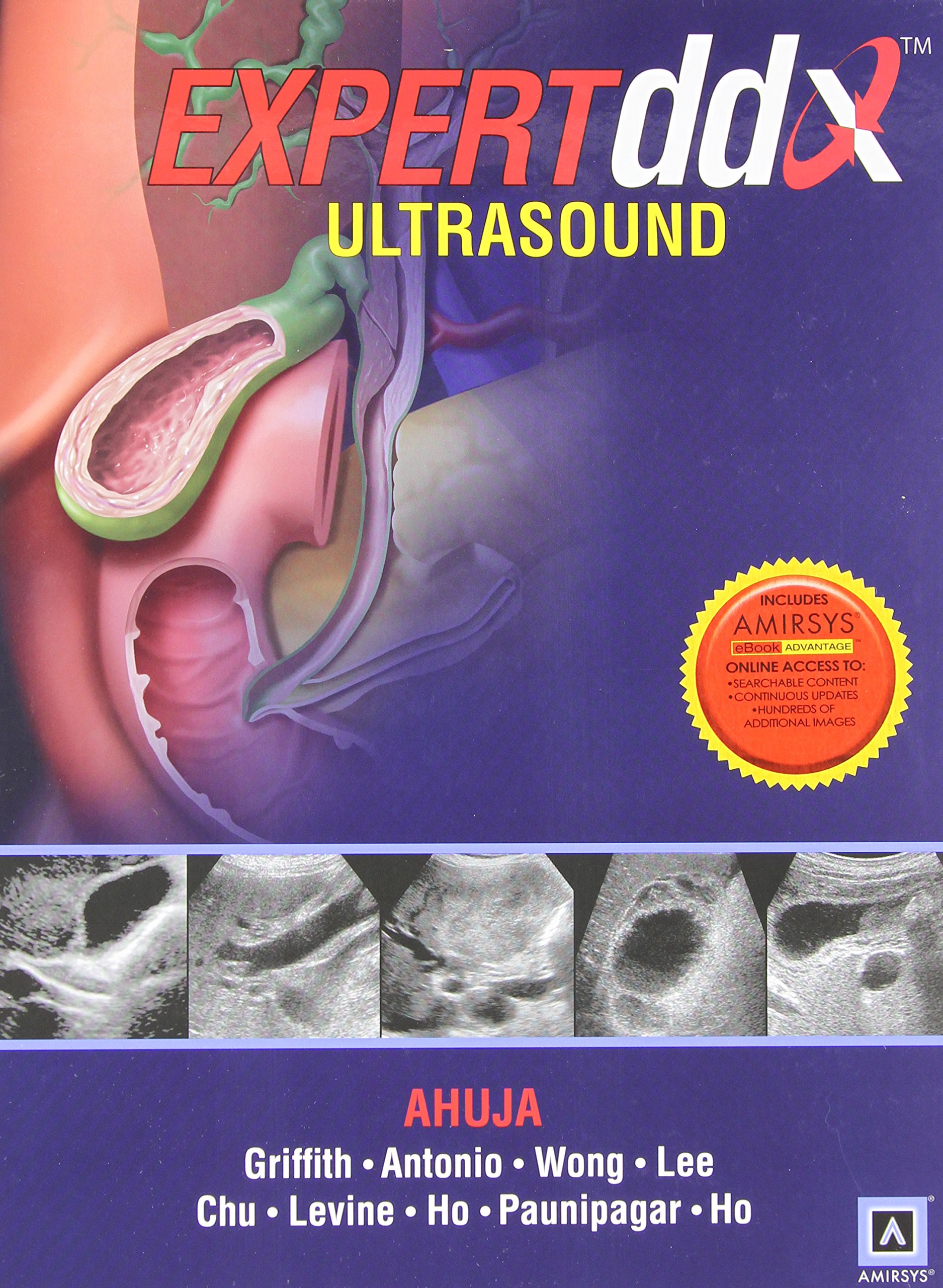 Expertddx: Ultrasound (OLD Edition)