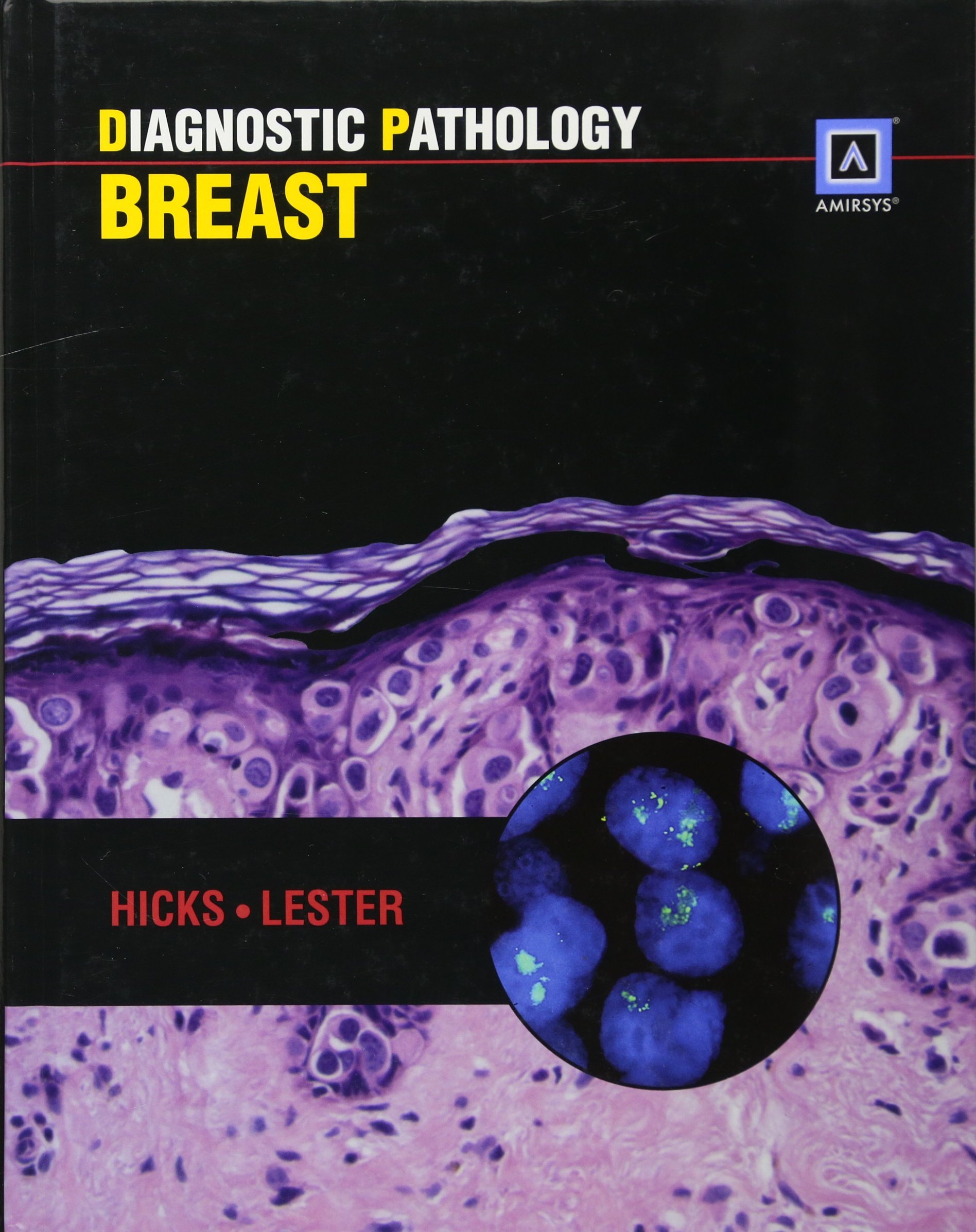 Diagnostic Pathology: Breast (Old Edition)
