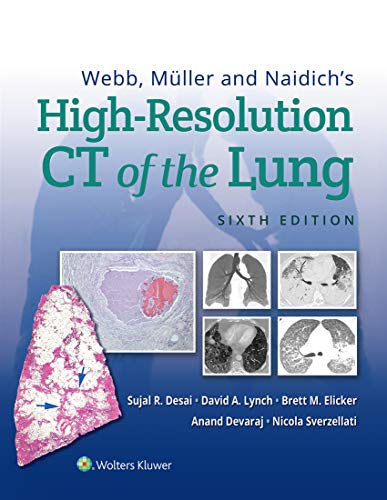 Webb, Müller And Naidich'S High-Resolution Ct Of The Lung 8Ed (Hb 2021)
