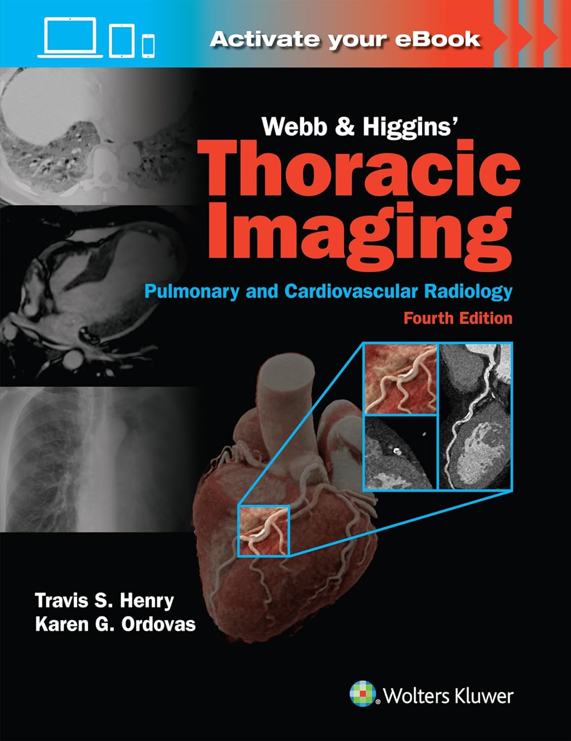 Webb & Higgins Thoracic Imaging: Print + eBook with Multimedia Fourth edition