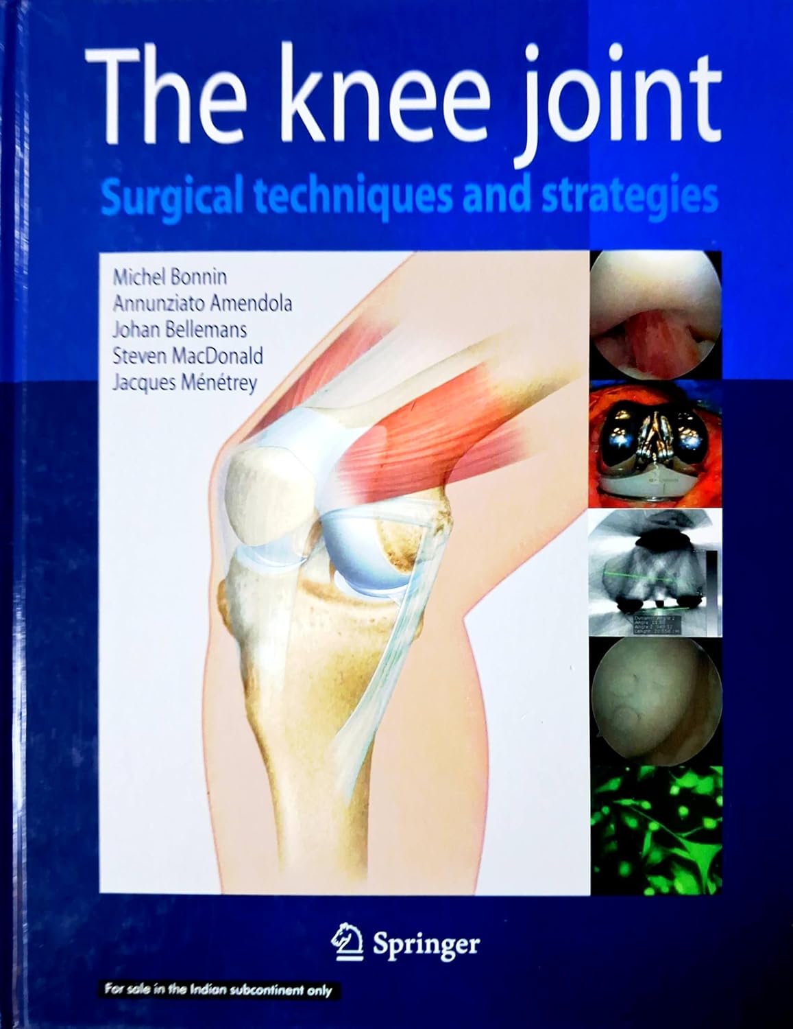 The Knee Joint Surgical Techniques And Strategies (Hb 2026)