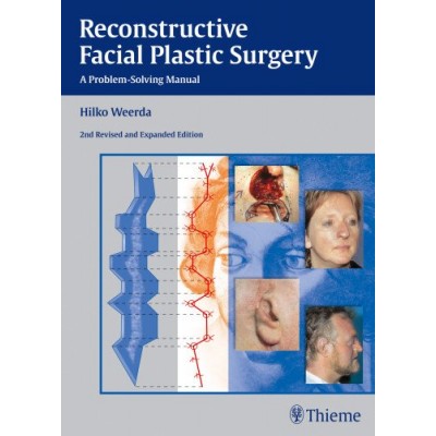 Reconstructive Facial Plastic Surgery: A Problem-Solving Manual: 2/e