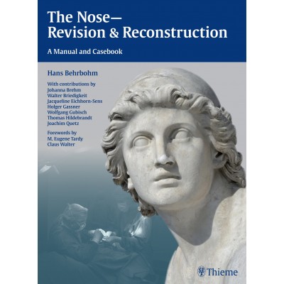 The Nose - Revision and Reconstruction: A Manual and Casebook: 1/e
