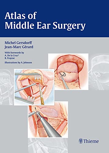 Atlas of Middle ear Surgery