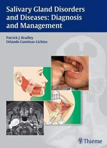 Salivary Gland Disorders And Diseases:: Diagnosis And Management: 1/E
