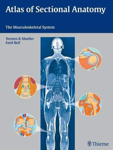 Atlas Of Sectional Anatomy: The Musculoskeletal System 1/E