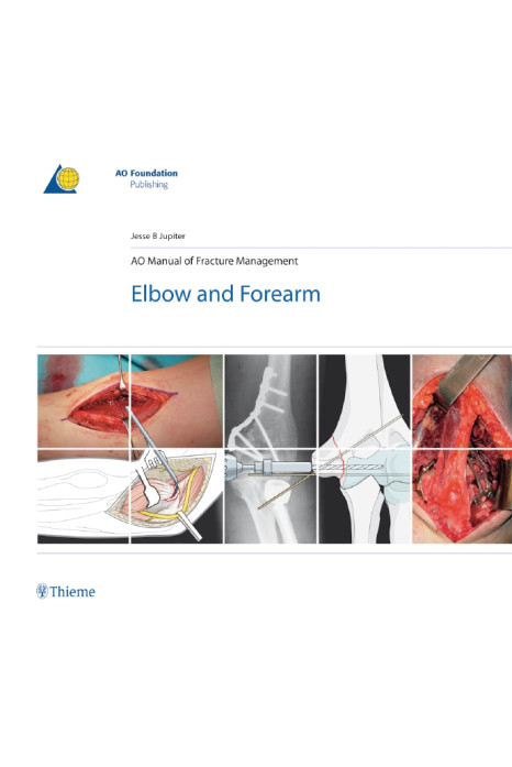 AO MANUAL OF FRACTURE MANAGEMENT ELBOW AND FOREARM