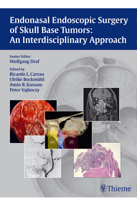 Endonasal Endoscopic Surgery of Skull Base Tumors 1st Edition