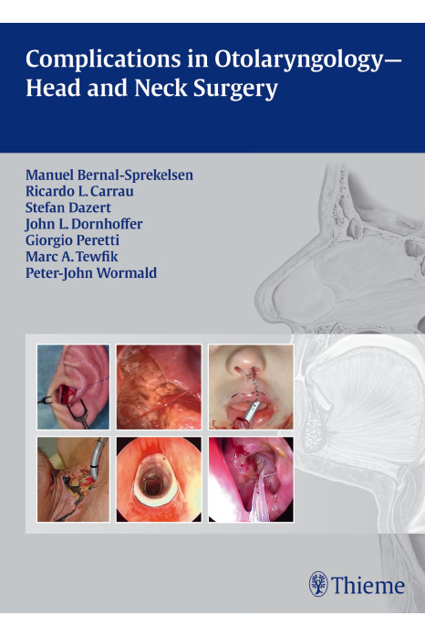 Complications in Otolaryngolgy-Head and Neck Surge