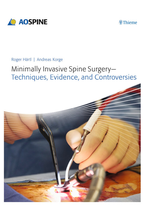 Minimally Invasive Spine Surgery-Techniques Eviden