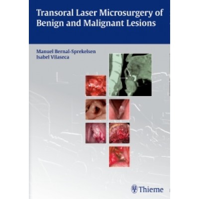 Transoral Laser Microsurgery of Benign and Malignant Lesions: 1/e