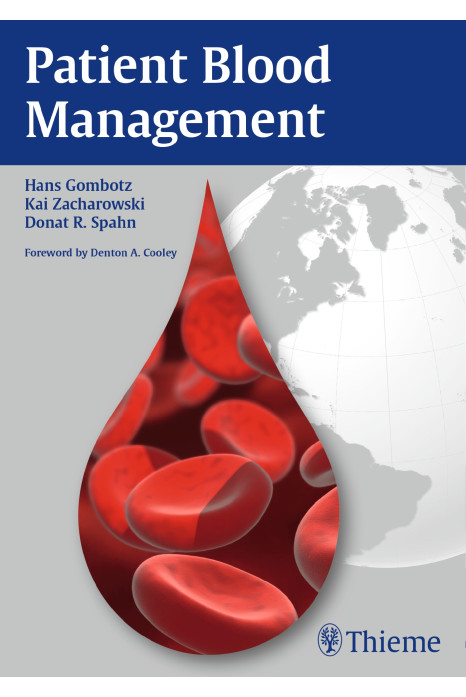 Patient Blood Management 1st Edition