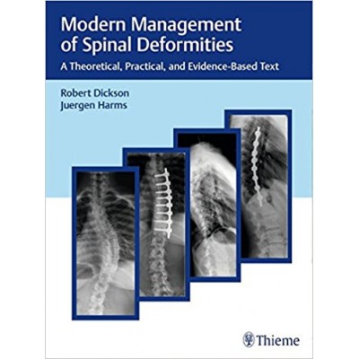 Modern Management of Spinal Deformities: A Theoretical, Practical, and Evidence-based Text: 1/e