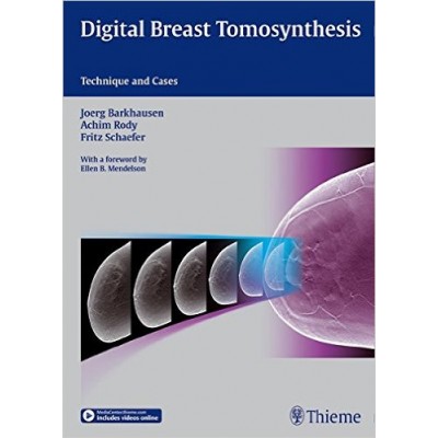 Digital Breast Tomosynthesis: Technique and Cases: 1/e