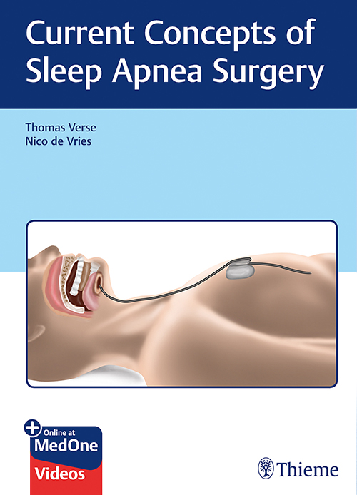 Current Concepts Of Sleep Apnea Surgery: 1/E