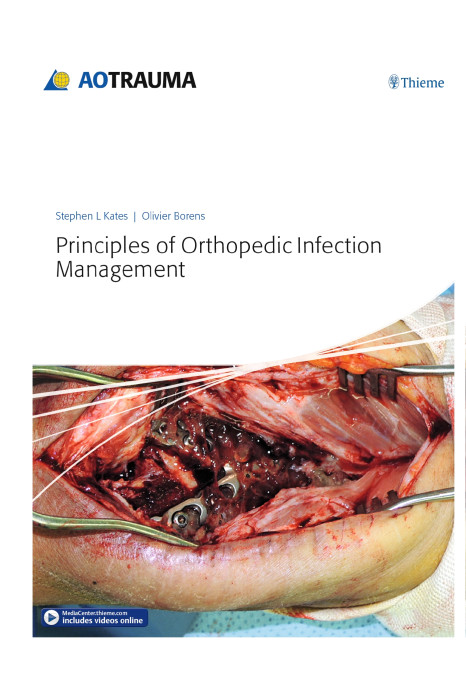 Principles of Orthopedic Infection Management 1st Edition