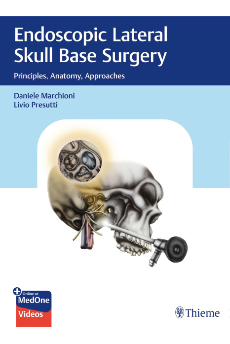 Endoscopic Lateral Skull Base Surgery : Principles, Anatomy, Approaches 1st Ed.