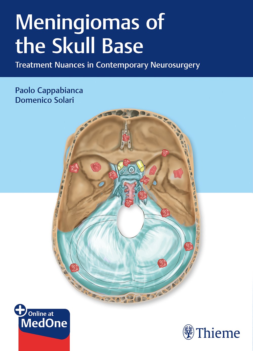 Meningiomas of the Skull Base: Treatment Nuances in Contemporary Neurosurgery: 1/e