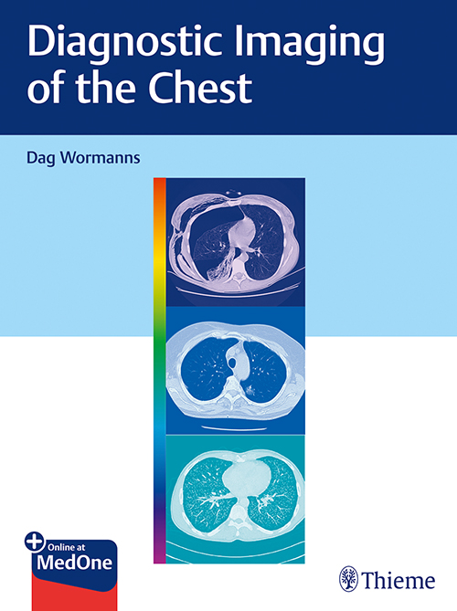 Diagnostic Imaging Of The Chest: 1/E