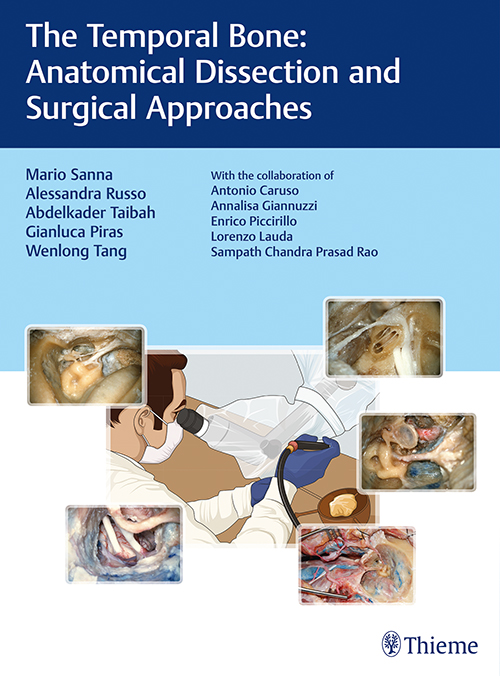 The Temporal Bone: Anatomical Dissection And Surgical Approaches: 1/E