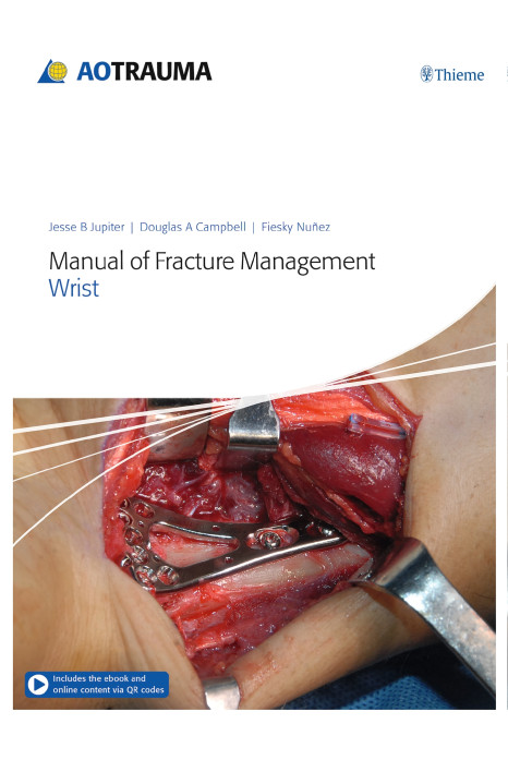 AO Trauma Manual of Fracture Management - Wrist 1st Edition