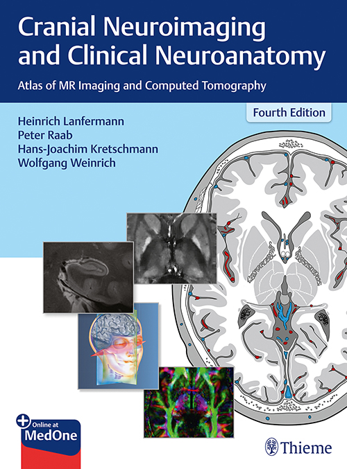 Cranial Neuroimaging And Clinical Neuroanatomy: 4/E