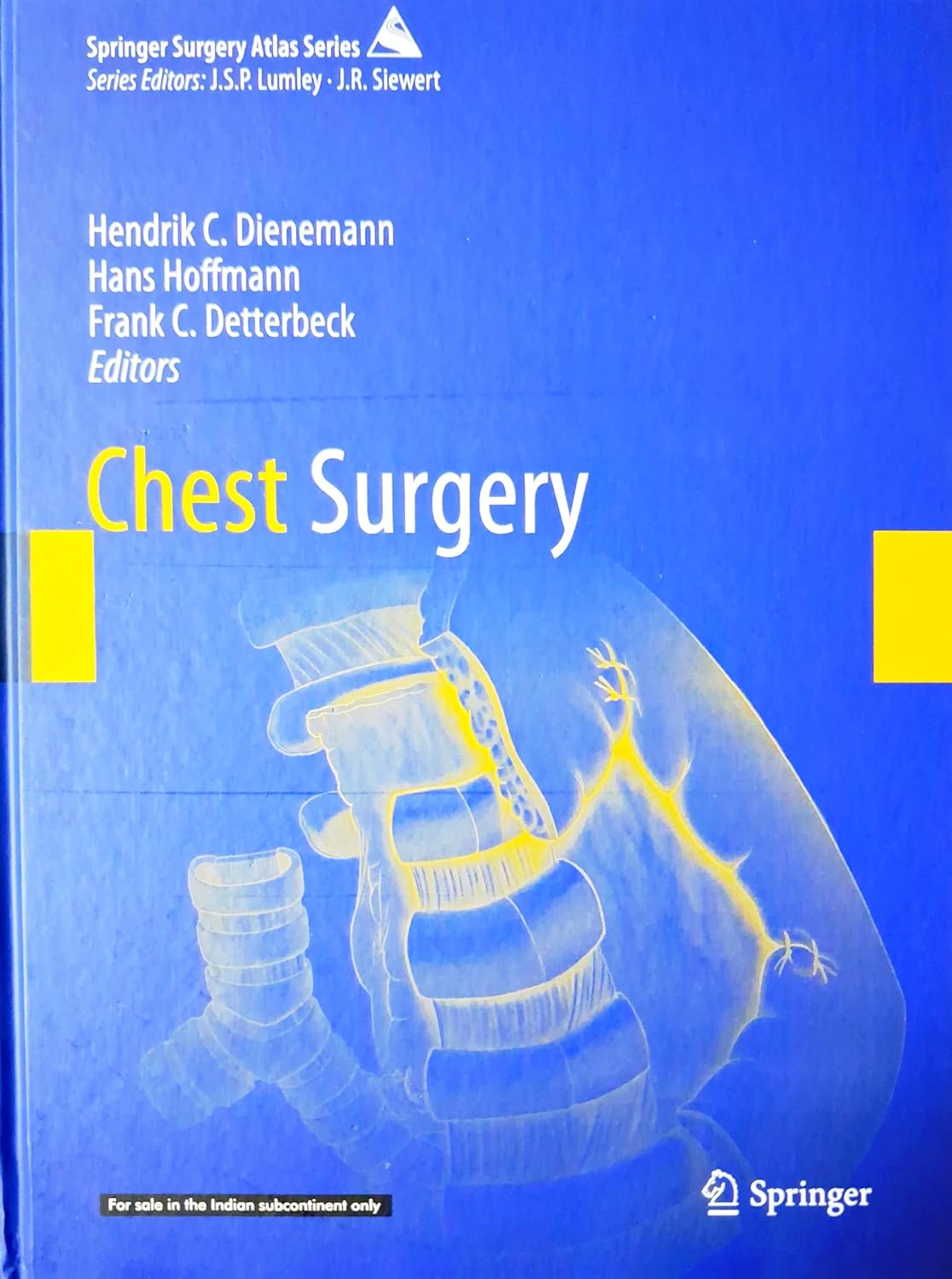 Chest Surgery (Hb 2026)