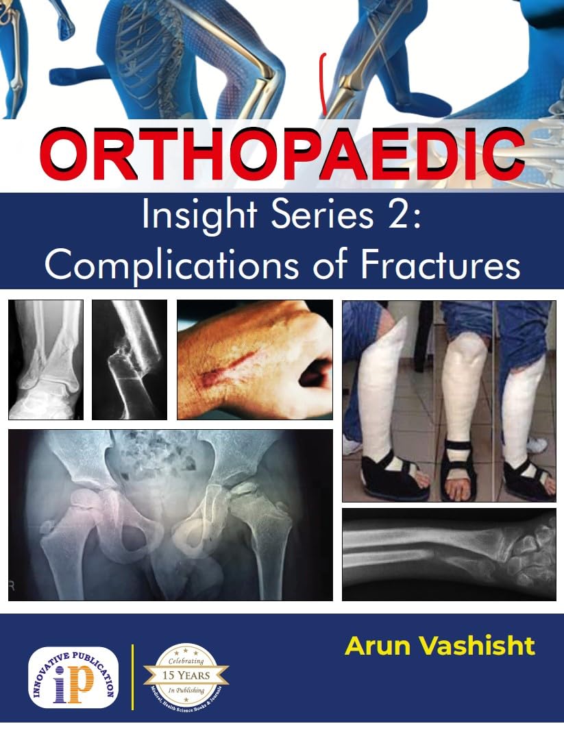 Orthopaedic Insight Series 2: Complications of Fractures