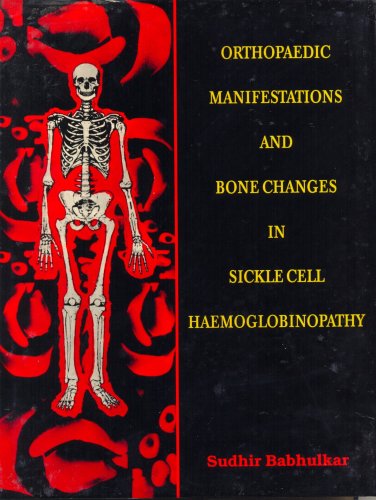 Orthopaedic Manifestations And Bone Changes In Sickle Cell Haemoglobinopathy  (1997)