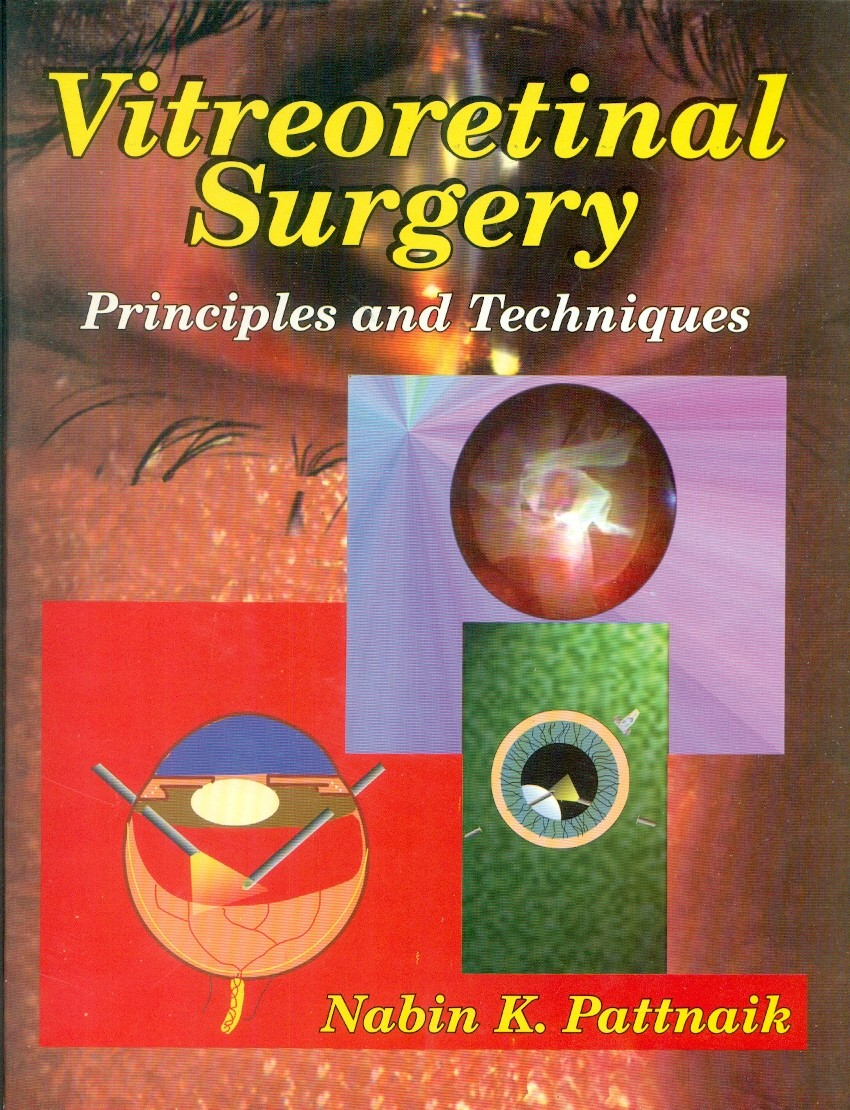 Vitreoretinal Surgery Principles And Techniques (Hb 2003)