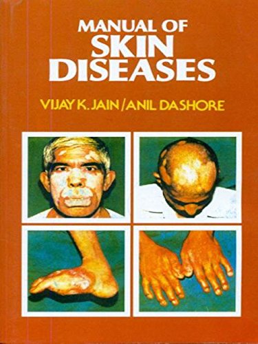 Manual Of Skin Diseases
