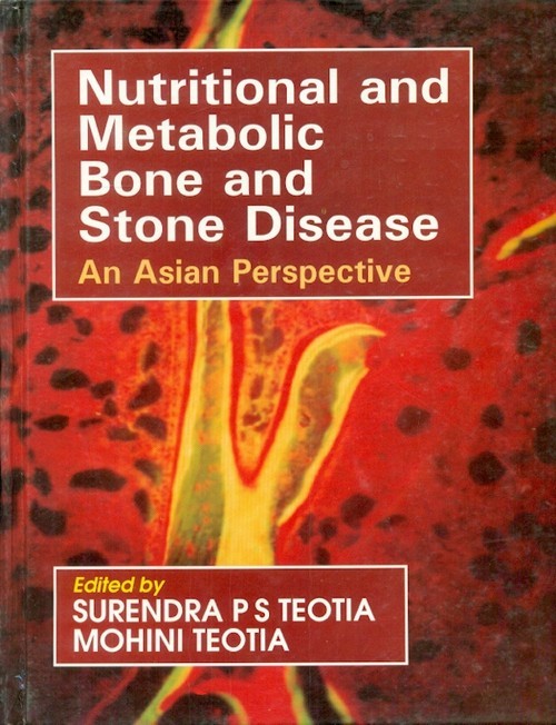 Nutritional And Metabolic Bone And Stone Disease An Asian Perspective (Hb 2009)