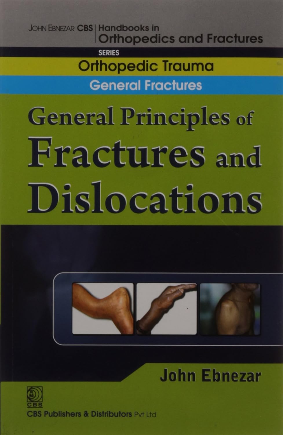 General Principles Of Fractures And Dislocations (Handbook Of Orthopedics And Fractures Series Vol 1 Orthopedic Trauma General Fractures (2012)