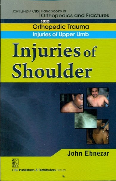 Injuries Of Shoulder (Handbook In Orthopedics And Fractures Series Vol 5 Orthopedic Trauma Injuries Of Upper Limb (2012)