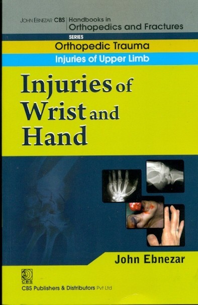 Injuries Of Wrist And Hand (Handbook In Orthopedics And Fractures Vol 9 Orthopedic Trauma Injuries Of Upper Limb (2012)