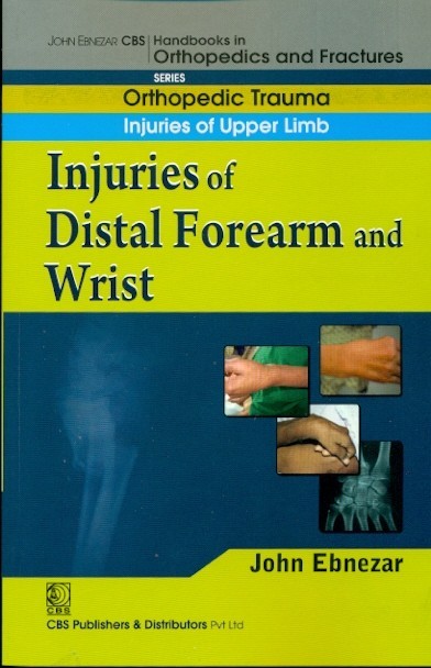 Injuries Of Distal Forearm And Wrist (Handbook In Orthopedics And Fractures Series Vol 10 Orthopedic Trauma Injuries Of Upper Limb (2012)