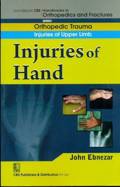 Injuries Of Hand (Handbooks In Orthopedics And Fractures Series Vol 11 Orthopedic Trauma Injuries Of Upper Limb (2012)