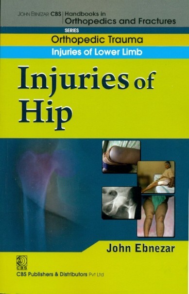 Injuries Of Hip (Handbook Of Orthopedics And Fratures Series Vol 13 Orthopedic Trauma Injuries Of Lower Limb (2012)