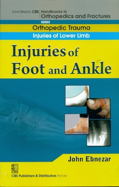 Injuries Of Foot And Ankle (Handbook In Orthopedics And Fractures Series Vol 18 Orthopedic Trauma Injuries Of Lower Limb (2012)