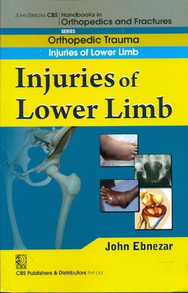 Injuries Of Lower Limb (Handbook In Orthopedics And Fractures Vol 19 Orthopedic Trauma Injuries Of Lower Limb (2012)