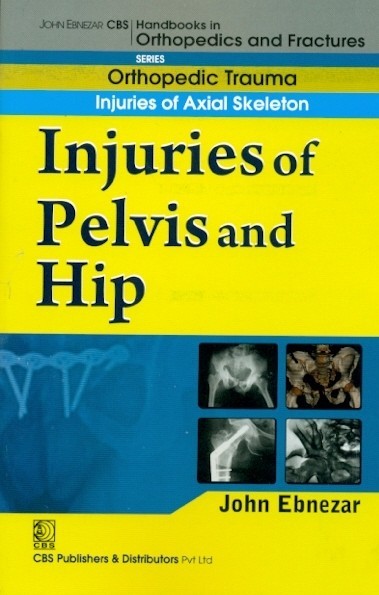 Injuries Of Pelvis And Hip (Handbook In Orthopedics And Fractures Vol 20 Orthopedic Trauma Injuries Of Axial Skeleton (2012)