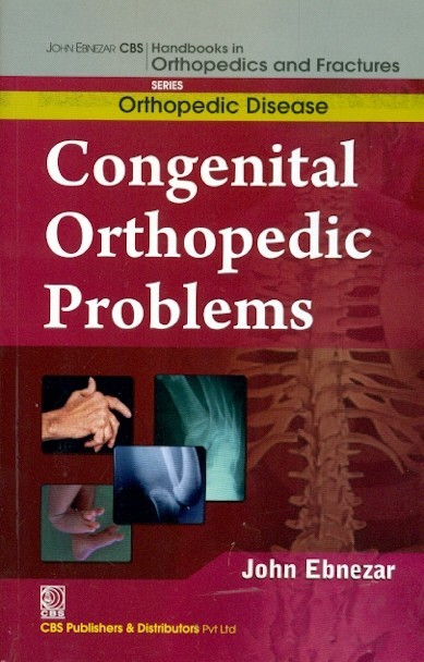 Congenital Orthopedic Problems (Handbooks In Orthopedics And Fractures Series Vol 28 Orthopedic Disease) A (2012)