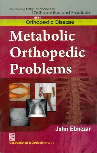 Metabolic Orthopedic Problems (Handbooks In Orthopedics And Fractures Series Vol 30 Orthopedic Disease) (2012)